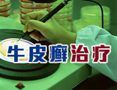 银屑病可以根治吗